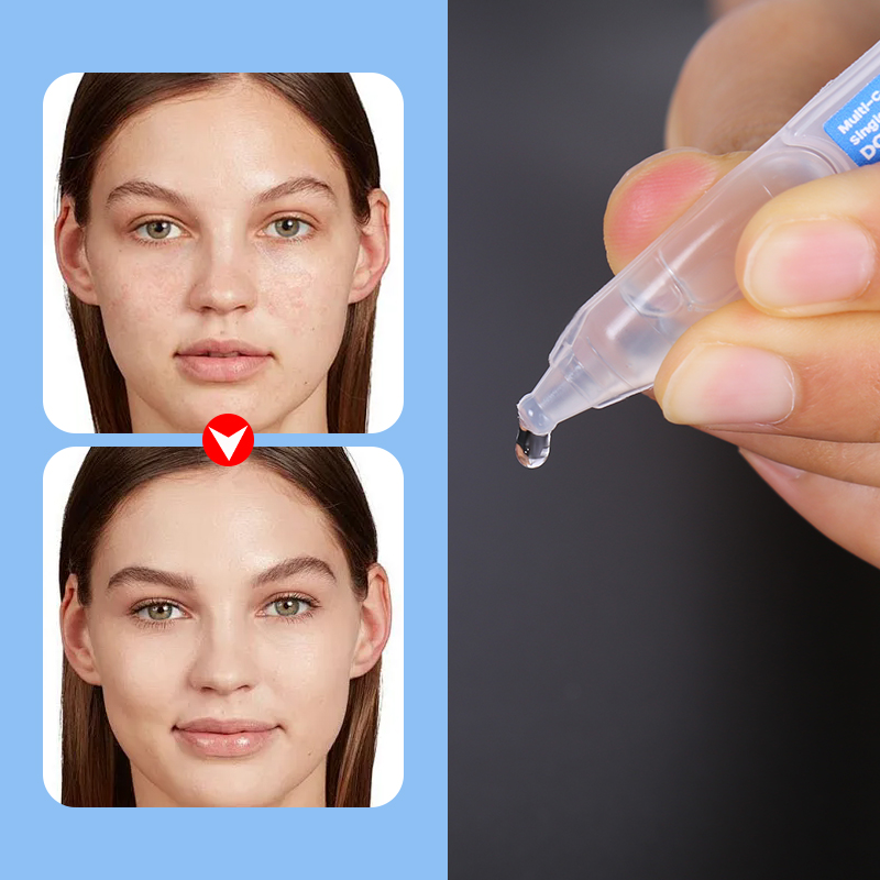 Single Dose Pdrn Polypeptide Salmon Dna Serum Curcuma Longa Turmeric Root Soothing Repair Serum E for Face - 11